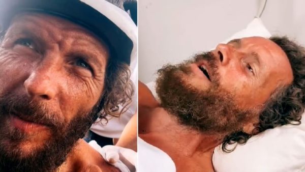 Jovanotti coinvolto in incidente in bicicletta: gravi fratture al femore e alla clavicola