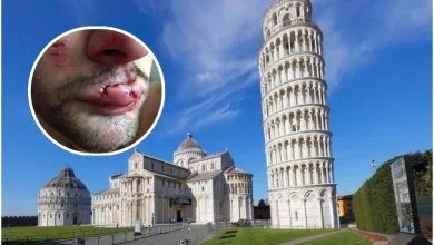 Studente sardo aggredito a Pisa, pugno in faccia e corsa in ospedale