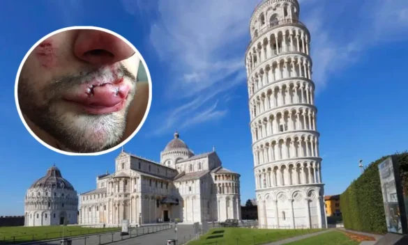 Studente sardo aggredito a Pisa, pugno in faccia e corsa in ospedale